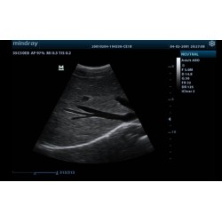 Ultrasound System (DP-20)